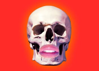 Plastic Surgeons Are Using Material From Dead People on New Patients