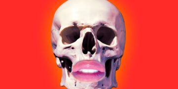 Plastic Surgeons Are Using Material From Dead People on New Patients