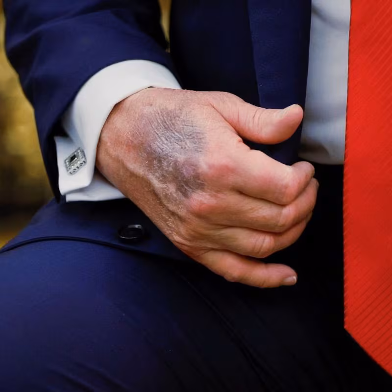 Trump hand