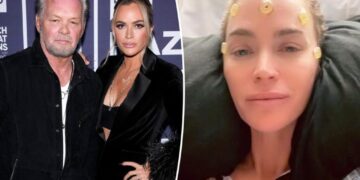 Teddi Mellencamp says she’s ‘struggling’ in cancer battle after dad John’s concerning comments