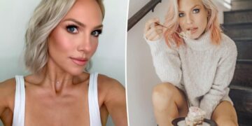 ‘DWTS’ alum Sharna Burgess details past eating disorder and ‘super complicated’ relationship with food