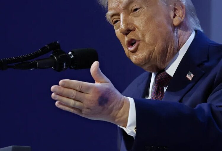 Greenland deal doesn’t solve ‘mutual alienation’ between America and its allies, economists warn, and it puts the dollar under threat