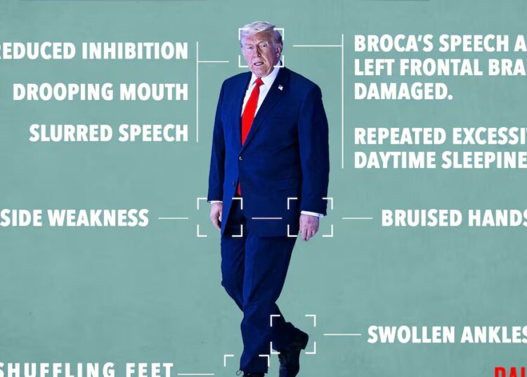 Opinion: These Are the Physical and Mental Signs Trump Has Had a Stroke: Doctor