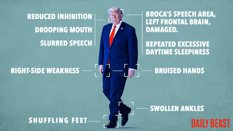 Donald Trump's many medical issues.