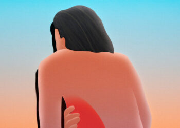 Her Sudden Back Pain Was Unbearable. What Could Ease It?