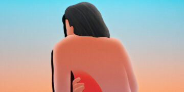 Her Sudden Back Pain Was Unbearable. What Could Ease It?