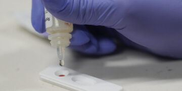 5,500-year-old DNA shows syphilis was rooted in the Americas, before Columbus