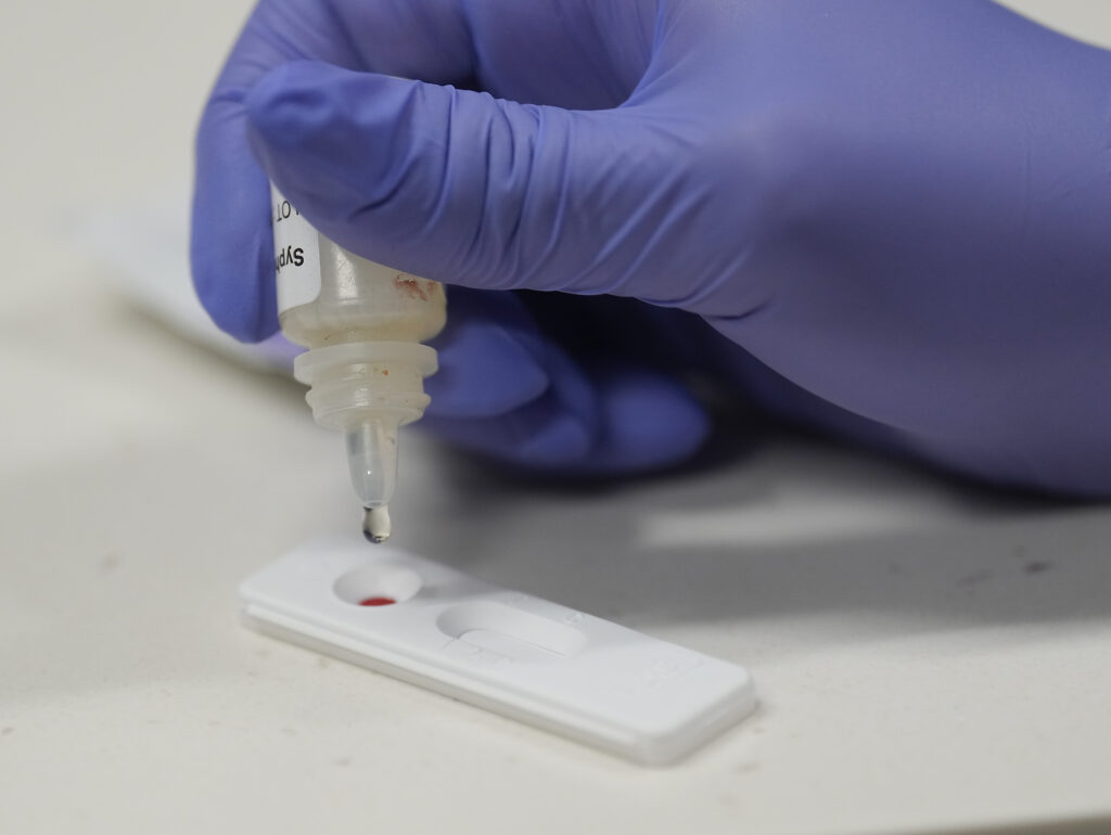 5,500-year-old DNA shows syphilis was rooted in the Americas, before Columbus