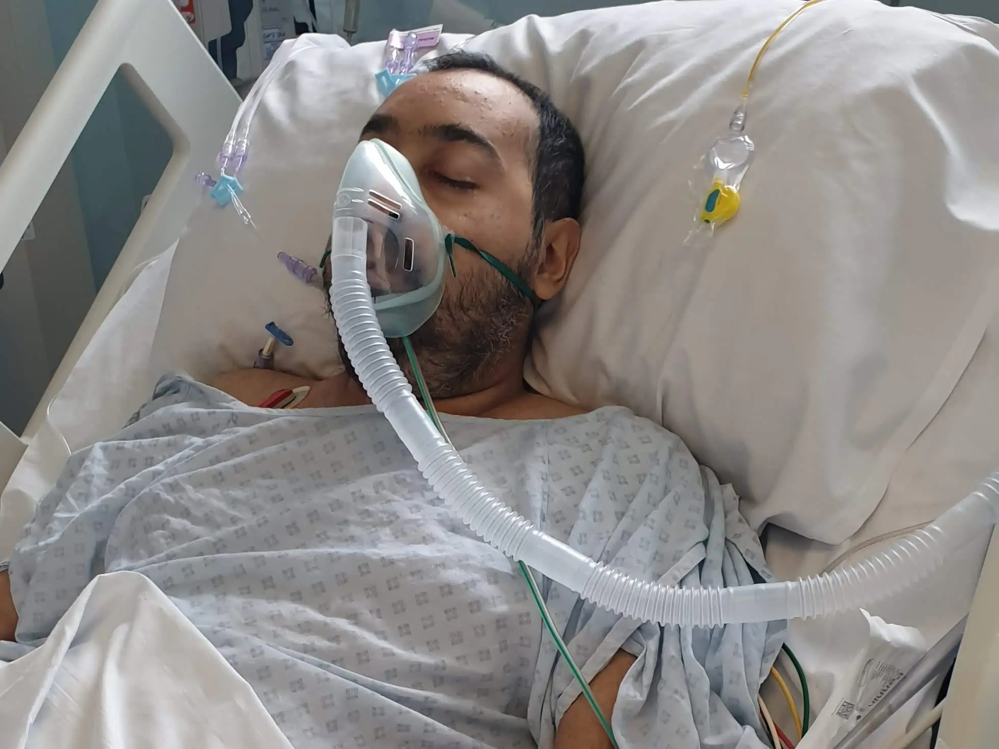 A man hooked up to a breathing tube in a hospital bed.