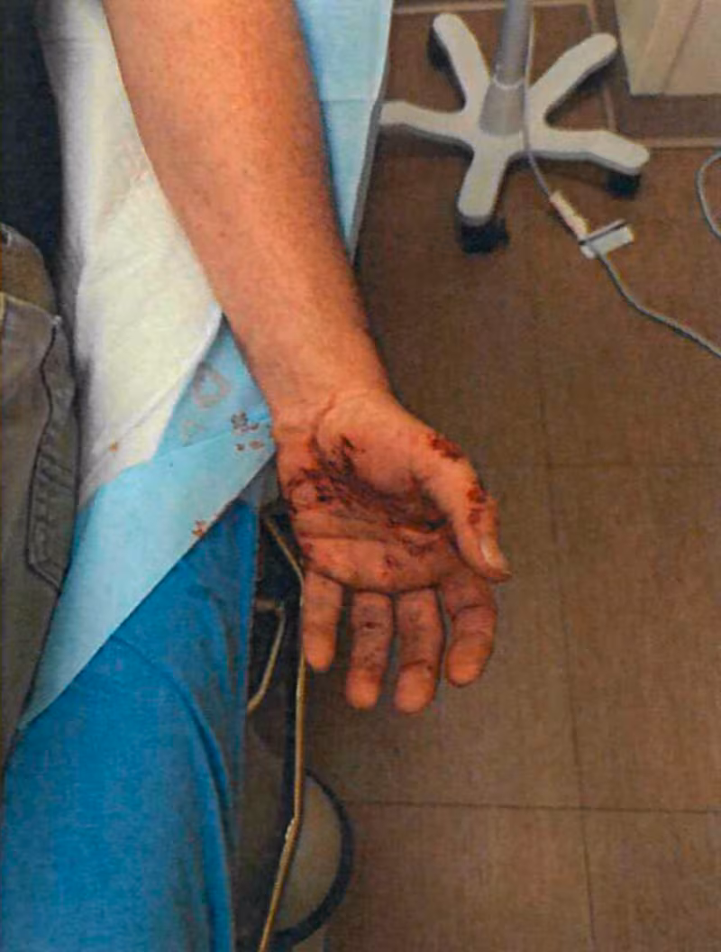 Jonathan Ross was hospitalized in June 2025 after he was dragged by a car during an immigration operation, a federal complaint says.