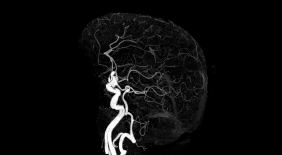 8 Unhinged Things Your Brain Does to ‘Protect’ You