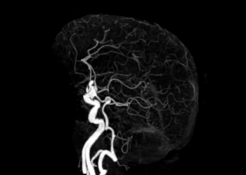 8 Unhinged Things Your Brain Does to ‘Protect’ You