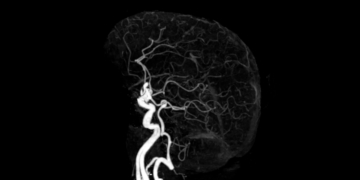 8 Unhinged Things Your Brain Does to ‘Protect’ You