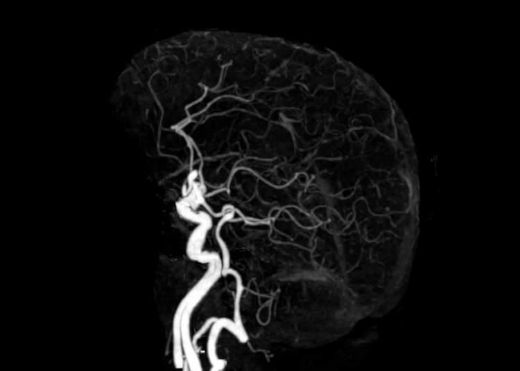 8 Unhinged Things Your Brain Does to ‘Protect’ You