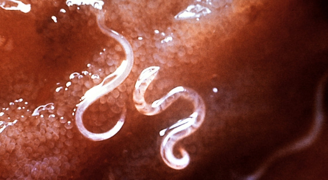 The 8 Weirdest Wellness Cleanses in History (Including One That Used a Live Parasite)