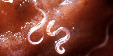 The 8 Weirdest Wellness Cleanses in History (Including One That Used a Live Parasite)