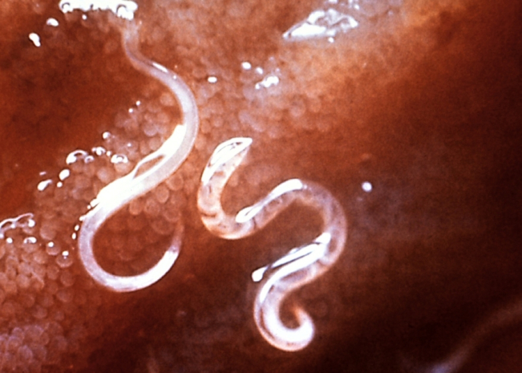 The 8 Weirdest Wellness Cleanses in History (Including One That Used a Live Parasite)