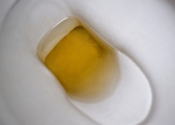 Why Is My Pee Blue? 9 Weird Pee Smells and Colors, Explained
