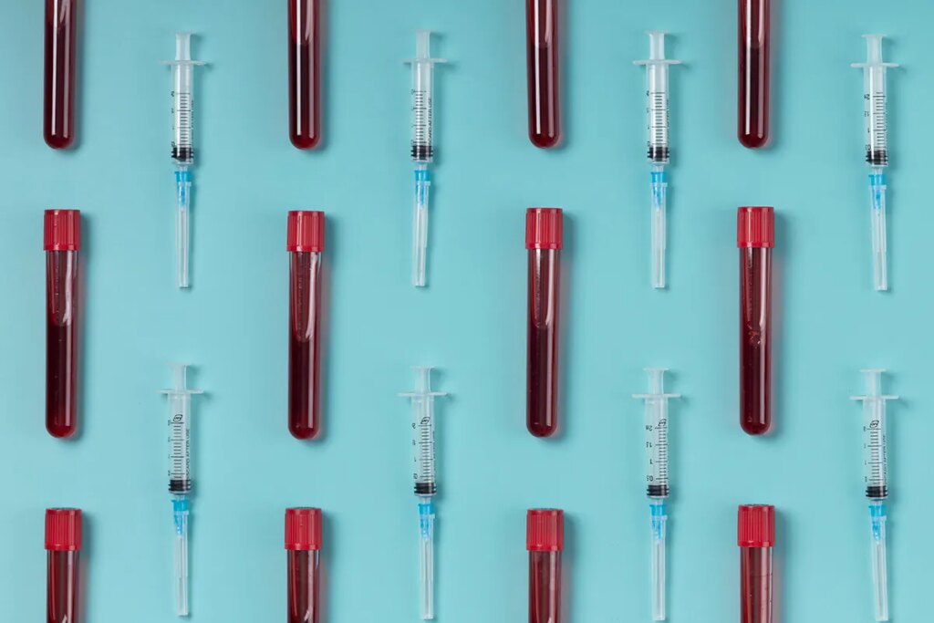 Blood Feud: Oura’s Health Panels Versus Whoop’s Advanced Labs