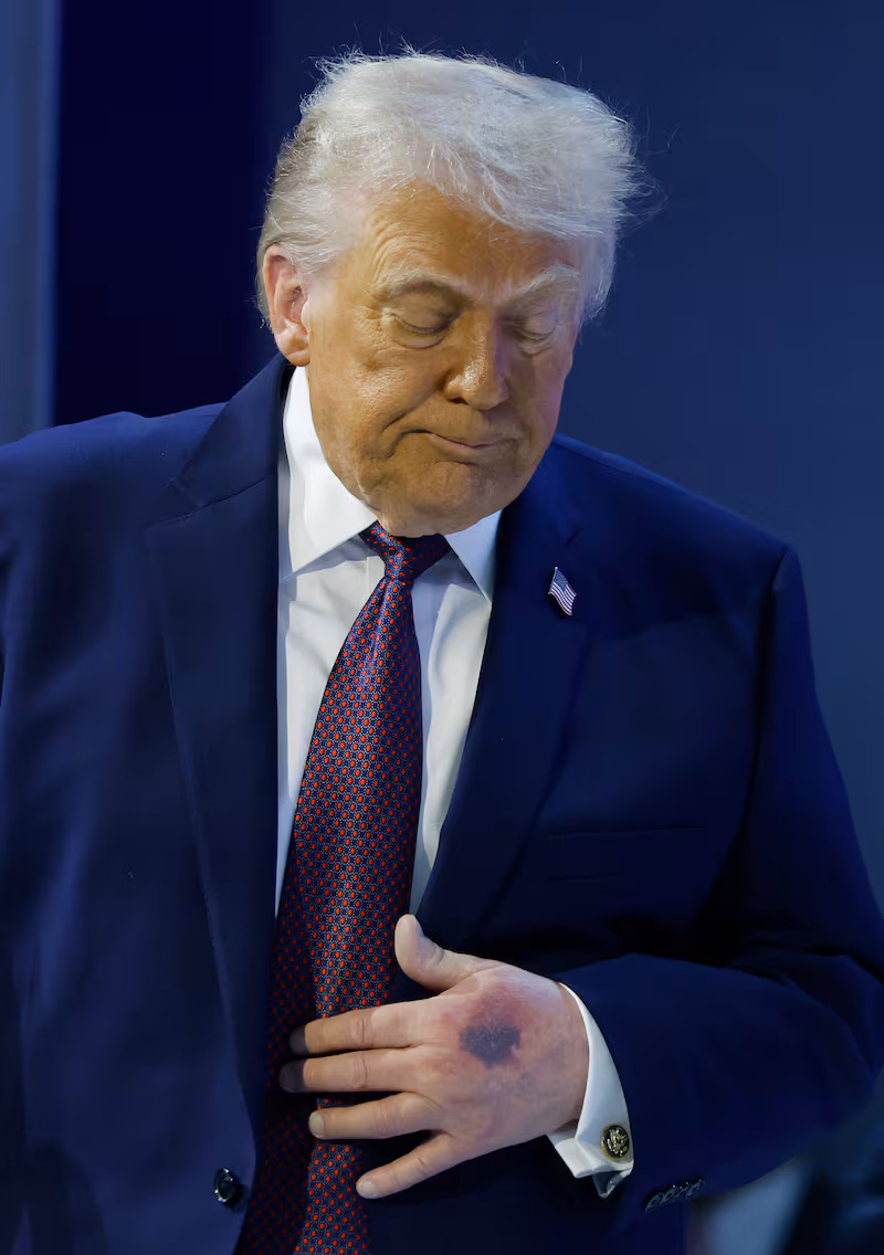 President Donald Trump looks on after holding a signing ceremony for the “Board of Peace” at the World Economic Forum (WEF) on January 22, 2026 in Davos, Switzerland.