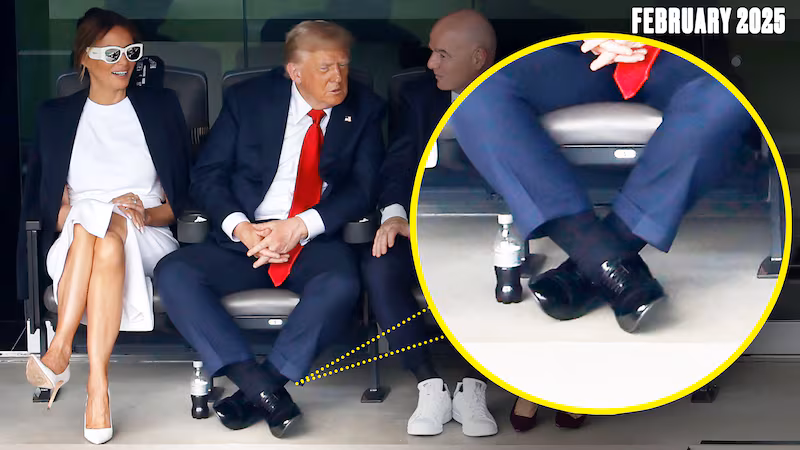 Donald Trump's cankles are often seen spilling over his shoes.