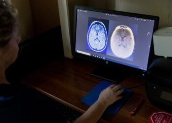 Quest for a drug that lowers an artery-clogging particle nears finish line