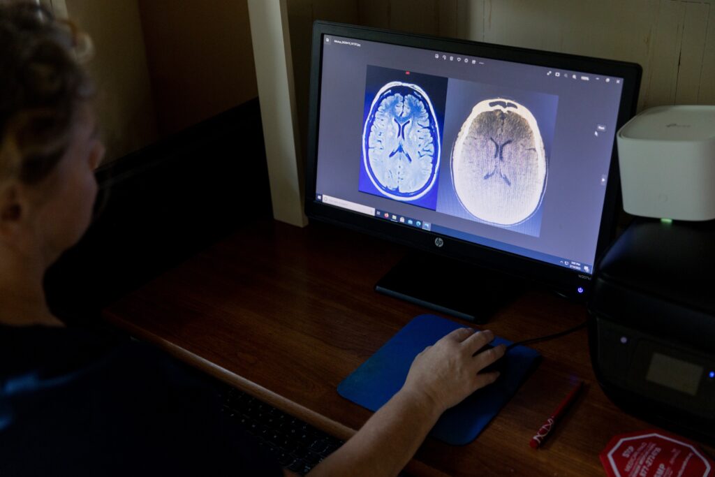 Quest for a drug that lowers an artery-clogging particle nears finish line