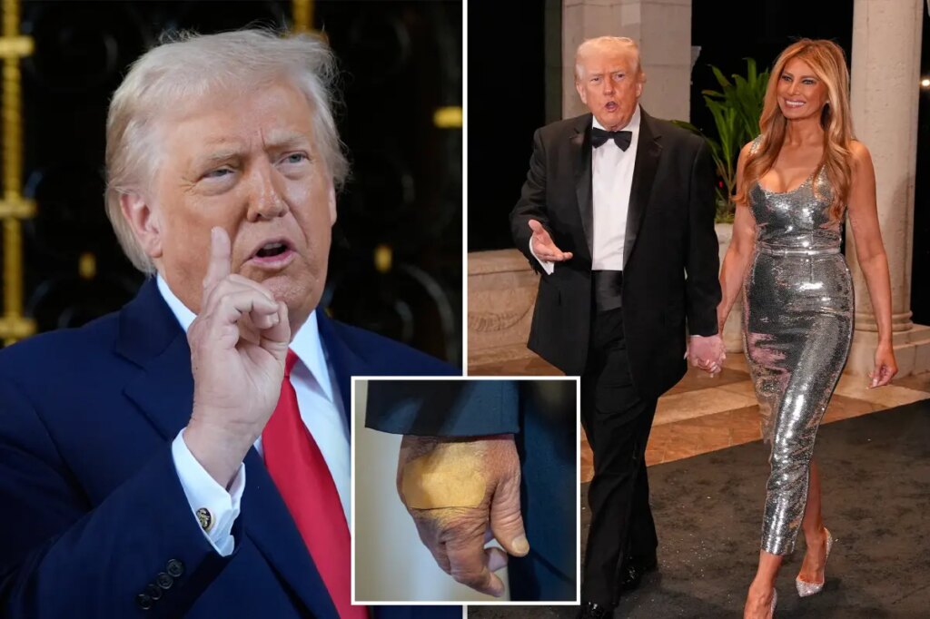 Trump doubles down, insists he is in ‘perfect health’ and he ‘aced’ cognitive exam