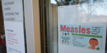 Measles Outbreak in South Carolina Worsens