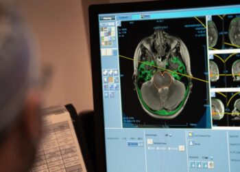 A $2,500 full body scan said he was healthy. Then he had a catastrophic stroke.