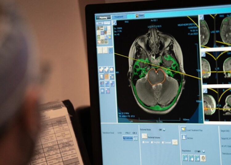 A $2,500 full body scan said he was healthy. Then he had a catastrophic stroke.