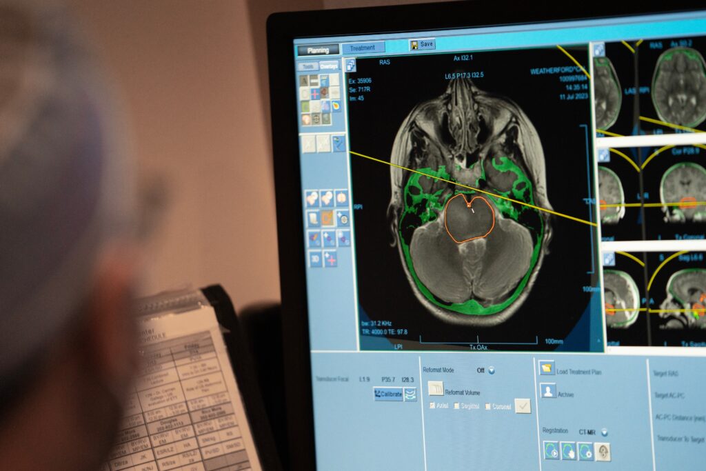 A $2,500 full body scan said he was healthy. Then he had a catastrophic stroke.