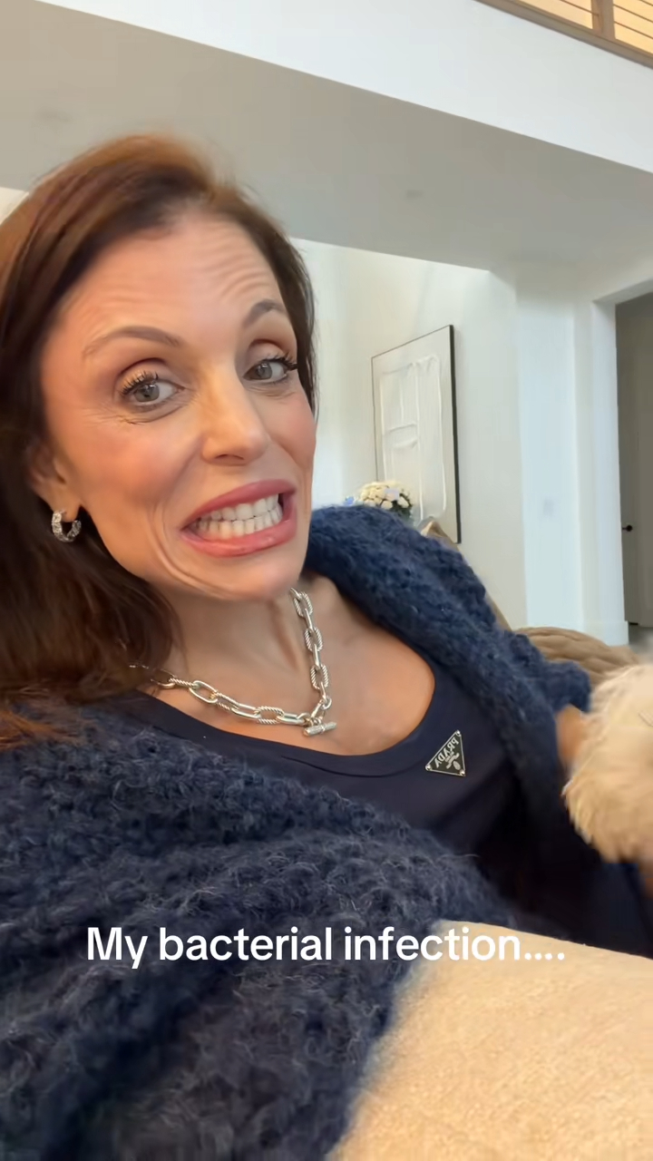 Bethenny Frankel grimacing while showing her facial rash.