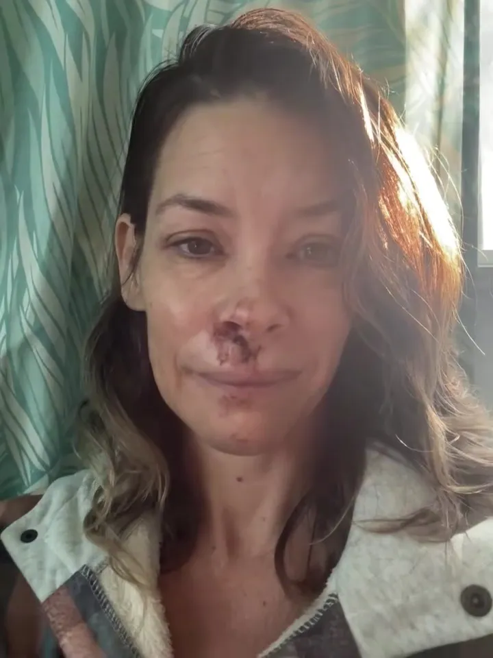 Evangeline Lilly with dried blood on her nose and chin.