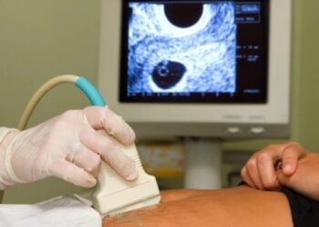 GOP trap backfires as red state’s highest court kills abortion bans