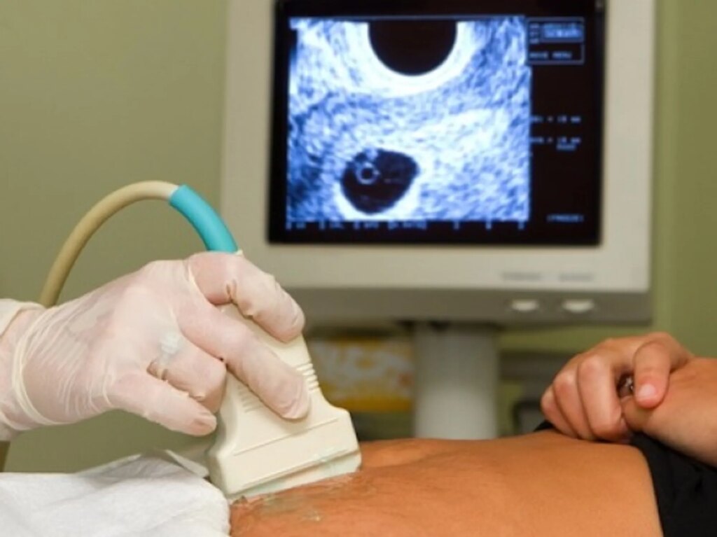 GOP trap backfires as red state’s highest court kills abortion bans