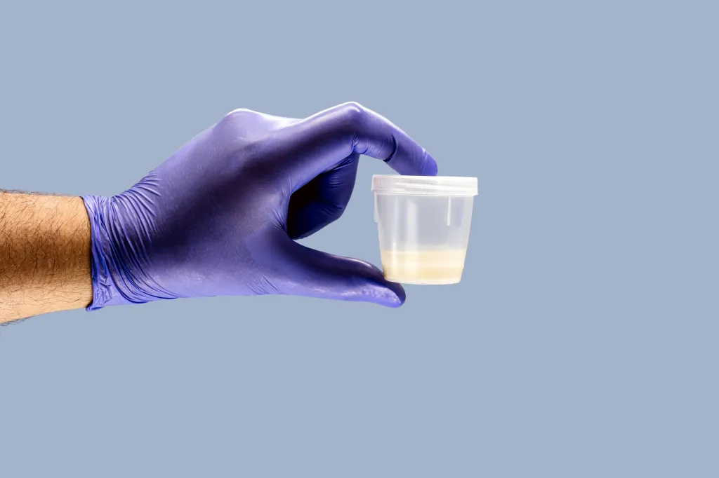Hand in a blue nitrile glove holding a cup with a semen sample.