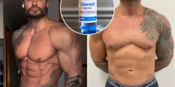 I took steroids for a decade — it had a very unwelcome effect on my nipples