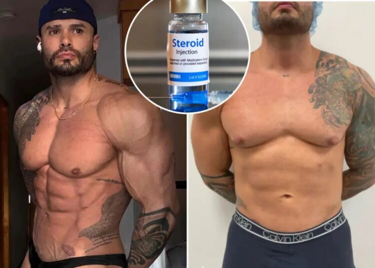 I took steroids for a decade — it had a very unwelcome effect on my nipples