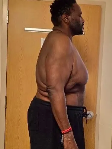 Aaron had lost 200 pounds while on a weight loss journey just months ago.