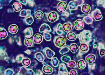 The US Is In For Another Bad Year of Measles Cases