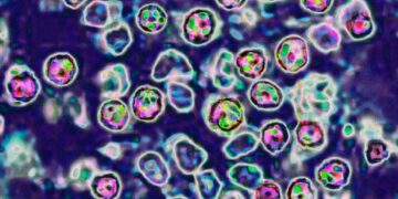 The US Is In For Another Bad Year of Measles Cases