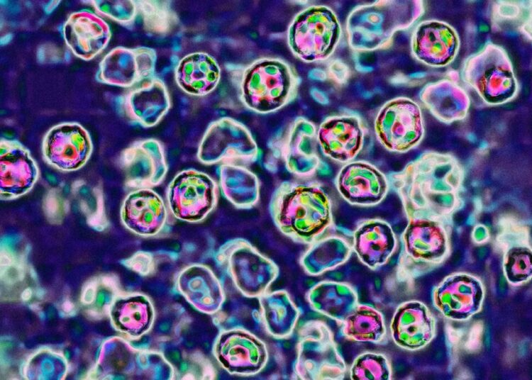 The US Is In For Another Bad Year of Measles Cases