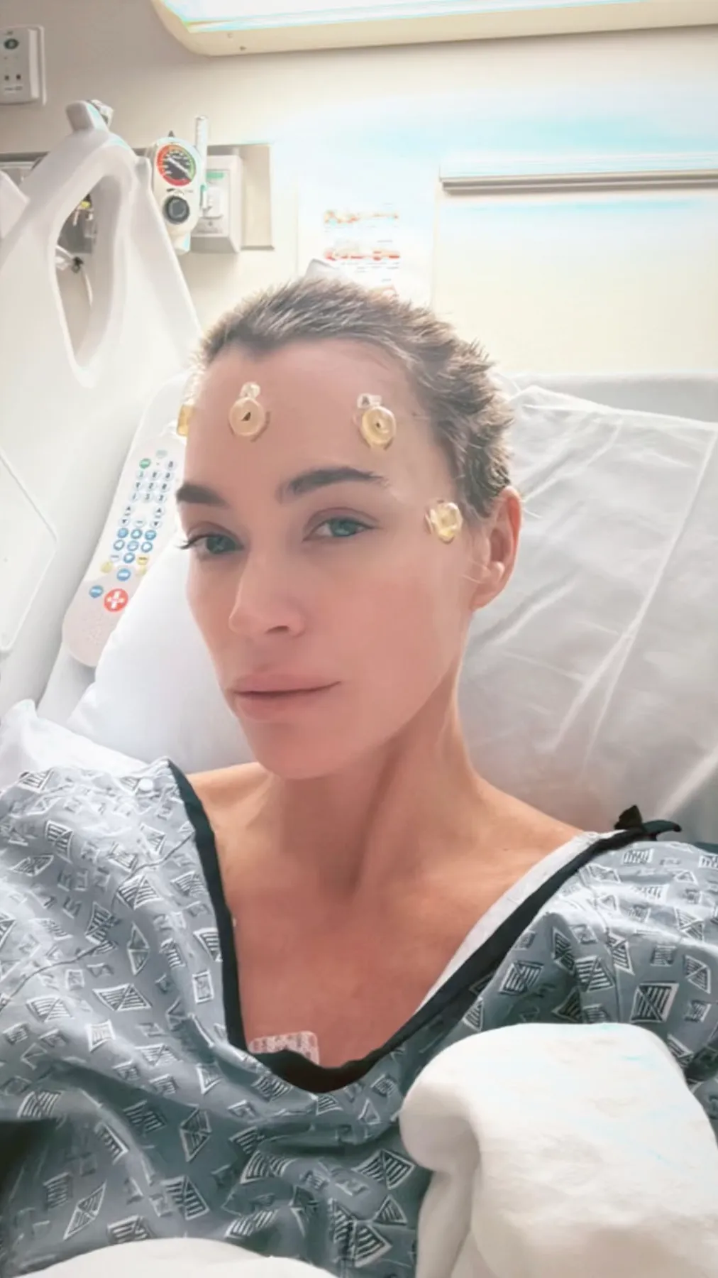 Teddi Mellencamp in a hospital bed with medical sensors on her forehead.