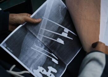 A bullet shattered her knee. Now a Gaza teen’s chances of walking depend on Rafah crossing’s opening