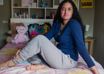 Man Is Charged in 2021 Acid Attack Against Woman on Long Island