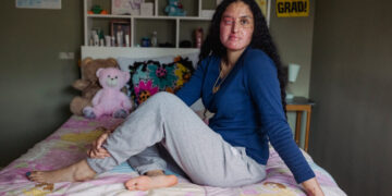 Man Is Charged in 2021 Acid Attack Against Woman on Long Island