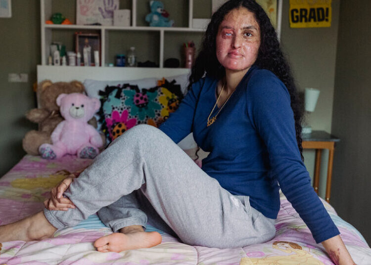 Man Is Charged in 2021 Acid Attack Against Woman on Long Island