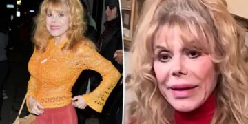 Charo, 75, opens up about embracing aging — and how she stands up for herself: ‘Nobody’s going to screw me’