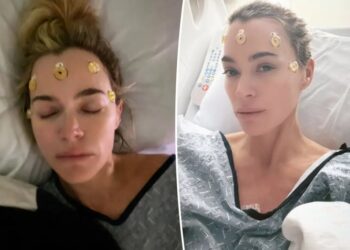 Teddi Mellencamp marks 1st anniversary of her brain surgery with emotional reflection